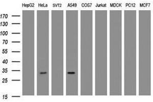 Image no. 2 for anti-Inhibitor of Growth Family, Member 2 (ING2) antibody (ABIN1498886) (ING2 Antikörper)