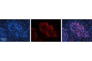 Rabbit Anti-BUD31 Antibody   Formalin Fixed Paraffin Embedded Tissue: Human Testis Tissue Observed Staining: Nucleus in spermatogonia and spermatocytes Primary Antibody Concentration: 1:100 Other Working Concentrations: N/A Secondary Antibody: Donkey anti-Rabbit-Cy3 Secondary Antibody Concentration: 1:200 Magnification: 20X Exposure Time: 0. (BUD31 Antikörper  (N-Term))