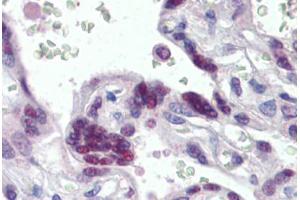 Human Placenta (formalin-fixed, paraffin-embedded) stained with MORF4L1 antibody ABIN462283 followed by biotinylated anti-goat IgG secondary antibody ABIN481715, alkaline phosphatase-streptavidin and chromogen. (MORF4L1 Antikörper  (AA 2-14))