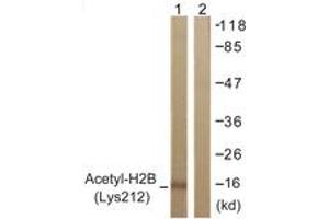 Western blot analysis of extracts from COS7 cells, treated with TSA 400nM 24h, using Histone H2B (Acetyl-Lys12) Antibody. (Histone H2B Antikörper  (acLys12))