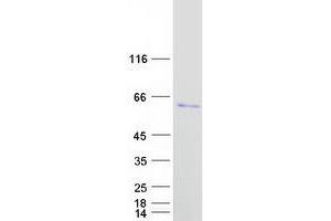 Western Blotting (WB) image for Eukaryotic Translation Initiation Factor 5 (EIF5) (Transcript Variant 1) protein (Myc-DYKDDDDK Tag) (ABIN2720106)