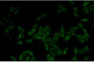 Immunofluorescence analysis of HeLa cells using DNM1 Polyclonal Antibody (Dynamin 1 Antikörper)