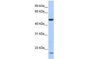 WB Suggested Anti-ZNF764 Antibody Titration:  0. (ZNF764 Antikörper  (N-Term))