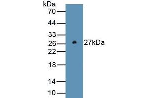 Detection of Recombinant FTH, Human using Monoclonal Antibody to Ferritin, Heavy Polypeptide (FTH) (FTH1 Antikörper  (AA 1-183))