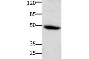 Western Blot analysis of Mouse heart tissue using CD116 Polyclonal Antibody at dilution of 1:400 (CSF2RA Antikörper)