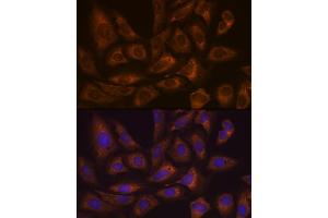 anti-Fragile X Mental Retardation, Autosomal Homolog 1 (FXR1) antibody