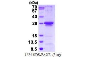 Image no. 1 for Regulator of G-Protein Signaling 1 (RGS1) (AA 1-209) protein (His tag) (ABIN1098296)