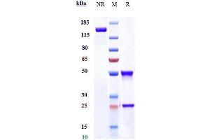Anti-LY75 / CD205/DEC-205 Reference Antibody (MEN1309) on SDS-PAGE under reducing (R) condition.