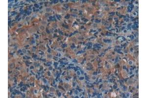 Used in DAB staining on fromalin fixed paraffin- embedded stomach tissue (P-Selectin Antikörper  (AA 58-158))