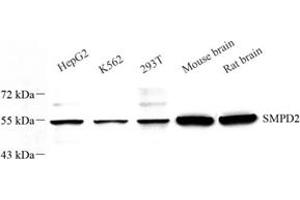 Western blot analysis of nSMase (ABIN7075702) at dilution of 1: 600 (SMPD2 Antikörper)