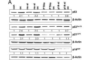 (A) LoVo cells were either exposed to PTHα (30 μM) or transfected with non-specific siRNA (ns-siRNA) or p14ARF specific siRNA. (Ziege anti-Maus IgG Antikörper (HRP))