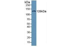 Detection of ITGaD in Human Serum using Polyclonal Antibody to Integrin Alpha D (ITGaD) (ITGAD Antikörper  (AA 879-1099))
