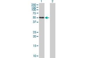Western Blot analysis of CALR expression in transfected 293T cell line by CALR MaxPab polyclonal antibody. (Calreticulin Antikörper  (AA 1-417))