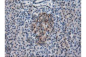 Immunohistochemical staining of paraffin-embedded Human pancreas tissue using anti-RBP1 mouse monoclonal antibody. (RBP1 Antikörper)