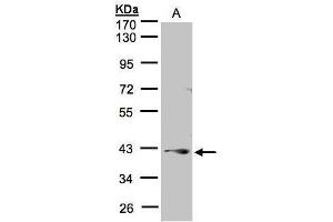 WB Image Sample(30 μg of whole cell lysate) A:A431, 10% SDS PAGE antibody diluted at 1:1000 (PPP2R4 Antikörper  (Center))
