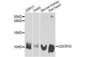 UQCR10 antibody  (AA 1-63)