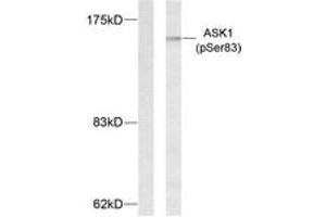 Western Blotting (WB) image for anti-Mitogen-Activated Protein Kinase Kinase Kinase 5 (MAP3K5) (pSer83) antibody (ABIN2888358) (ASK1 Antikörper  (pSer83))