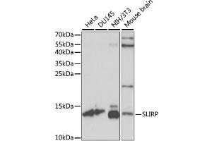 Western blot analysis of extracts of various cell lines, using SLIRP antibody. (SLIRP Antikörper)