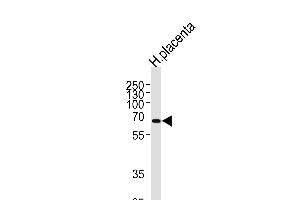 Western blot analysis of lysate from human placenta tissue lysate, using P19 Antibody (N-term) (ABIN657681 and ABIN2846673).