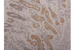 Immunohistochemistry (IHC) image for anti-Arginase, Type II (ARG2) (AA 23-354) antibody (ABIN7435613)