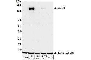 Western Blotting (WB) image for anti-Mast/stem Cell Growth Factor Receptor (KIT) (AA 325-375) antibody (ABIN7795658)