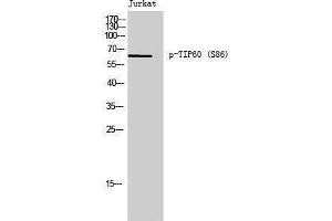 Western Blotting (WB) image for anti-K(lysine) Acetyltransferase 5 (KAT5) (pSer86) antibody (ABIN3182239) (KAT5 Antikörper  (pSer86))