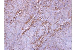 IHC-P Image Immunohistochemical analysis of paraffin-embedded Cal27 xenograft, using SIRT3, antibody at 1:500 dilution. (SIRT3 Antikörper  (C-Term))