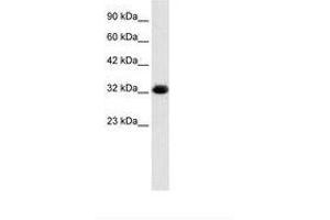 Image no. 1 for anti-Chromosome 22 Open Reading Frame 31 (C22orf31) (AA 113-162) antibody (ABIN202170) (C22orf31 Antikörper  (AA 113-162))