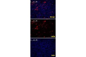 Confocal immunofluorescence analysis of methanol fixed HeLa cells were transfected with pMX construct of human LIN28, cells were analyzed ~62 hours after transfection.