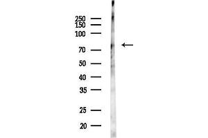 anti-phosphodiesterase 4C, CAMP-Specific (PDE4C) (Internal Region) antibody