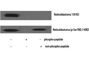 Western Blot (WB) analysis of specific cells using Phospho-Rb (S780) Polyclonal Antibody. (Retinoblastoma 1 Antikörper  (pSer780))