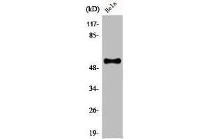 Western Blot analysis of HeLa cells using CREB3L2 Polyclonal Antibody (CREB3L2 Antikörper  (Internal Region))