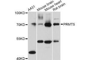 Western blot analysis of extracts of various cell lines, using PRMT5 Antibody (ABIN5970714) at 1:3000 dilution.