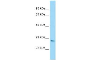 WB Suggested Anti-NUDT7 Antibody Titration: 1. (NUDT7 Antikörper  (N-Term))