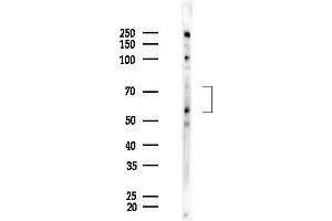 Western blot analysis of lysates from EC304 cells, using CSF2RA Antibody at 1/1000 dilution.