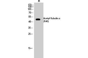 Western Blot analysis of JK cells using Acetyl-Tubulin α (K40) Polyclonal Antibody.