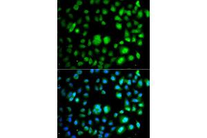 Immunofluorescence analysis of A549 cell using TET3 antibody. (TET3 Antikörper)
