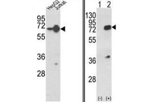 (LEFT) Western blot analysis of HNRPL Antibody (Center) in HepG2, Jurkat cell line lysates (35ug/lane). (HNRNPL Antikörper  (Middle Region))