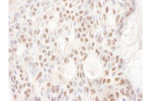 anti-Cyclin-Dependent Kinase-Like 5 (CDKL5) (AA 350-400) antibody