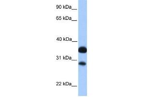 WB Suggested Anti-CITED2 Antibody Titration:  0. (CITED2 Antikörper  (N-Term))