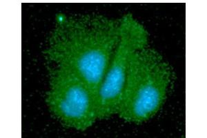 ICC/IF analysis of SGTA in Hep3B cells line, stained with DAPI (Blue) for nucleus staining and monoclonal anti-human SGTA antibody (1:100) with goat anti-mouse IgG-Alexa fluor 488 conjugate (Green). (SGTA Antikörper  (AA 1-313))