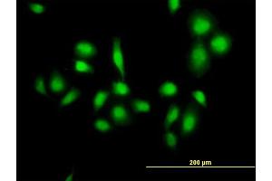 Immunofluorescence of purified MaxPab antibody to MDM4 on HeLa cell. (MDM4-binding Protein Antikörper  (AA 1-490))