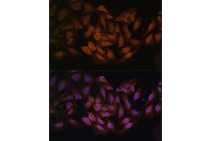 Immunofluorescence analysis of U-2 OS cells using CNBP antibody (ABIN7266165) at dilution of 1:100.