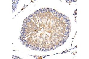 Immunohistochemistry of paraffin embedded mouse lung using MLF1 (ABIN7074712) at dilution of 1: 1500 (400x lens) (MLF1 Antikörper)