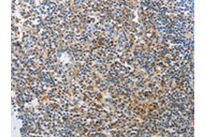 The image on the left is immunohistochemistry of paraffin-embedded Human tonsil tissue using ABIN7189642(AD7C-NTP Antibody) at dilution 1/25, on the right is treated with synthetic peptide. (AD7C-NTP Antikörper)