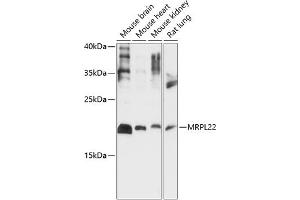 Western blot analysis of extracts of various cell lines, using MRPL22 antibody (ABIN7268563) at 1:1000 dilution. (MRPL22 Antikörper  (AA 97-206))