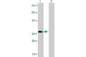 Western Blot analysis of ASCL1 expression in transfected 293T cell line by ASCL1 monoclonal antibody (M01), clone 7E11. (ASCL1 Antikörper  (AA 137-236))