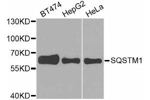 Western blot analysis of extracts of various cell lines, using SQSTM1 antibody. (SQSTM1 Antikörper)