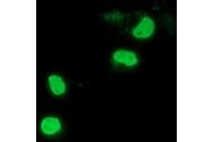 Anti-PPWD1 mouse monoclonal antibody (ABIN2453500) immunofluorescent staining of COS7 cells transiently transfected by pCMV6-ENTRY PPWD1 (RC204570). (PPWD1 Antikörper)