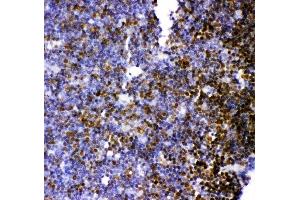 Anti-MCAK antibody, (ABIN3043278), IHC(P)IHC(P): Rat Thymus Tissue (KIF2C Antikörper  (AA 531-725))